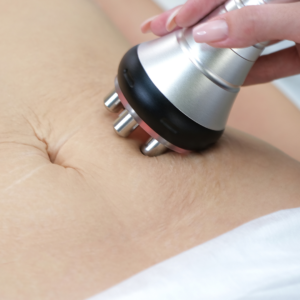 Radiofrequency skin tightening treatment on abdomen.