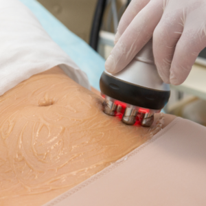 Cavitation treatment on belly with handheld device.