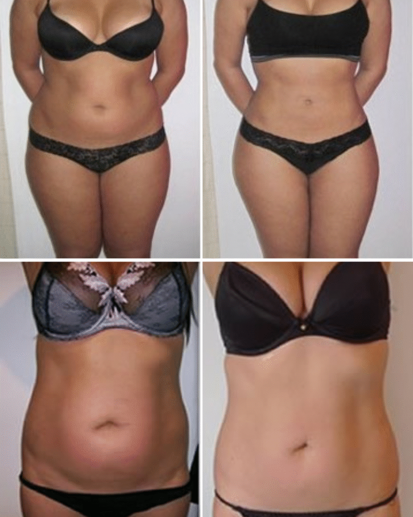 Before and after weight loss comparison