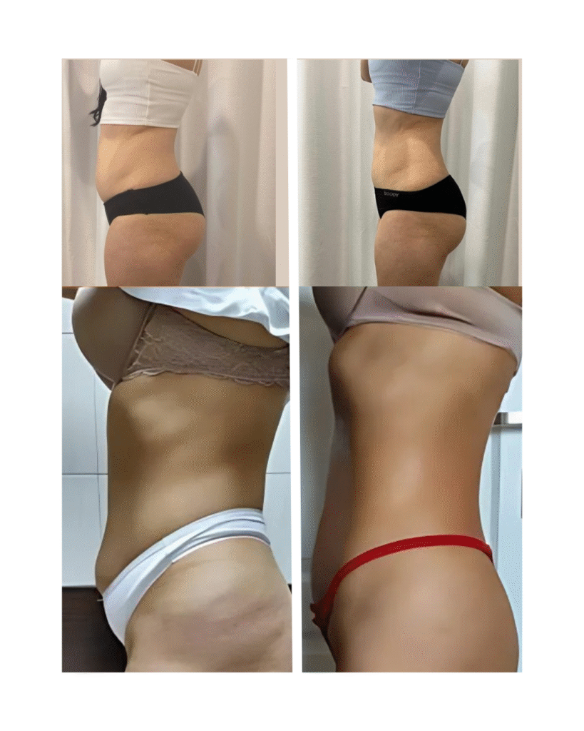 Before and after weight loss side profile comparison.