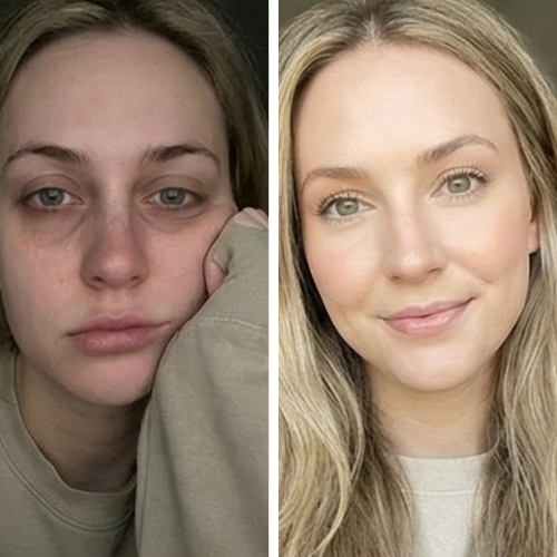 hydradermabrasion winnipeg47